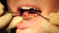 File photo dated 19/05/11 of a general view of a dentist at work. Mandatory jabs for healthcare worker could have a "devastating" consequence on stretched dental services, leading dentists have said.
