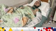 Alexandr Dyachanko in hospital in Kramatorsk after his building was hit by rocket attacks