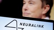 Musk said 'initial results show promising neuron spike detection'