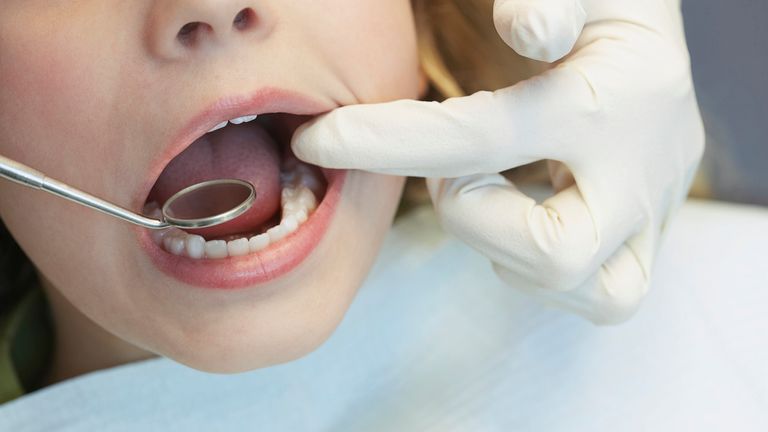 A file picture of a dentist examining someone's mouth. Pic: iStock
